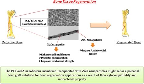  Iodine-Doped Hydroxyapatite: A Biomaterial Powerhouse for Bone Regeneration and Beyond!